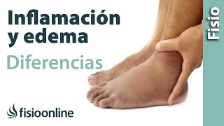 Inflamación y edema  Diferencias y características [upl. by Landing]