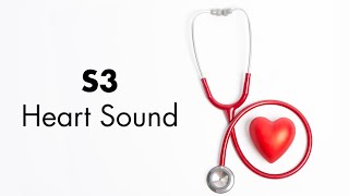 S3 Heart Sound  MEDZCOOL [upl. by Nihahs]