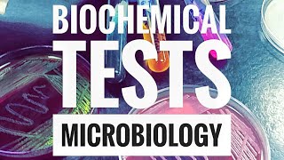 Biochemical TestsPart 1 [upl. by Eniamirt792]