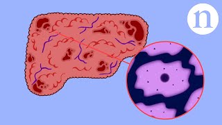 Scar wars Repairing the liver [upl. by Nigle]