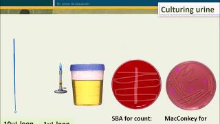 Urine Culture How To Interpret Count [upl. by Akcimehs516]