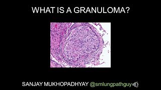 Necrosis  Cell Injury  General Pathology 🩺 [upl. by Elfrieda]