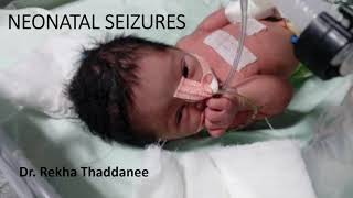 Neonatal Seizures  Pediatrics [upl. by Wawro875]