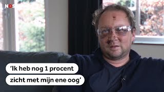 JAARWISSELING Vuurwerkslachtoffer Paul kreeg de volle laag [upl. by Guyon]