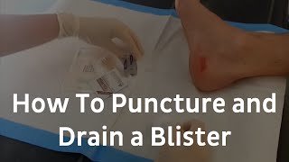 How To Puncture And Drain A Blister  Blister Treatment [upl. by Enitnelav908]