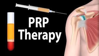 PRP Therapy Animation [upl. by Gereron925]