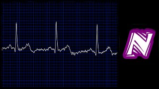 ECG Display Using Pulse Sensor amp OLED  Arduino with OLED amp Pulse Sensor [upl. by Garrick706]