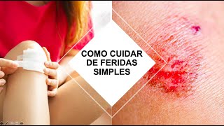 COMO CUIDAR DE FERIDAS SIMPLES Por Luiz Gameiro dermatologista [upl. by Ettezel]