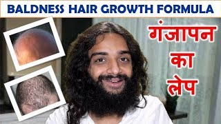 गंजापन का लेप BALDNESS AYURVEDIC HOME REMEDY HAIR REGROWTH FORMULA BY NITYANANDAM SHREE [upl. by Kos]