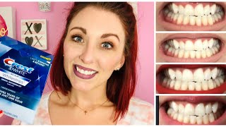 Crest 3D White One Hour Express Whitestrips CREST WHITENING BEFORE AND AFTER REVIEW [upl. by Bosson]