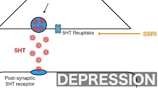 Major Depression and SSRIsSNRIs [upl. by Jackqueline]