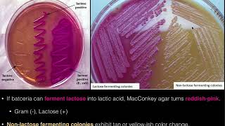 MacConkey Agar [upl. by Nollahs]