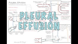 Pleurevac® MiniSahara S0500 Chest Drainage System  Overview amp Setup [upl. by Nila]