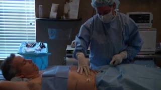 Vaser Liposuction  SmartLipo [upl. by Ledeen]