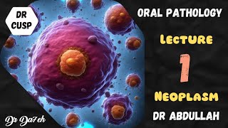 Lecture 1 Neoplasm Oral Pathology  Zagazig University [upl. by Introc]