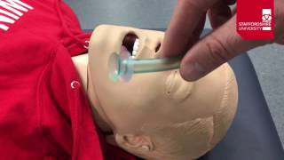 Nasopharyngeal Airway Insertion [upl. by Bettye]