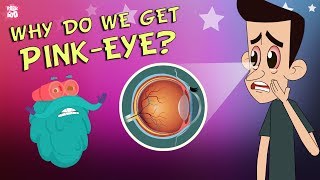 What Causes Conjunctivitis  CONJUNCTIVITIS  PinkEye  The Dr Binocs Show  Peekaboo Kidz [upl. by Brice]