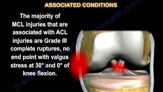 Medial Collateral Ligament injury  MCL Injuries  Everything You Need To Know  Dr Nabil Ebraheim [upl. by Atnaloj]