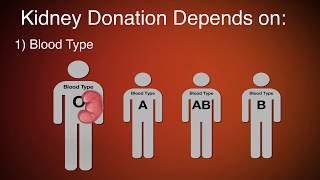 Robotic Partial Nephrectomy Patient Story [upl. by Alarice]