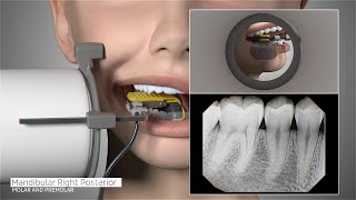 DEXIS™ Titanium by KaVo  Full Mouth Series Positioning Guide [upl. by Debor]