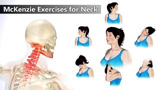 6 Mckenzie Exercises for Neck Pain Relief [upl. by Rica338]