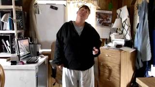 Generalised Dystonia Video  part 4 [upl. by Arno]