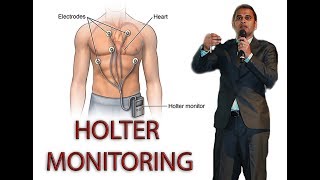 HOLTER MONITORING [upl. by Ellierim]