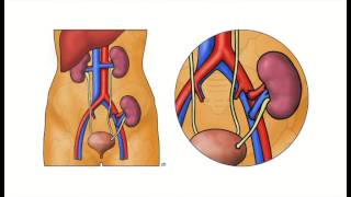 Lung Transplant Process [upl. by Siram]