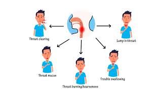 How to get rid of phlegm in your throat naturally [upl. by Trofmoc]