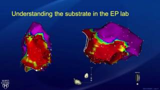 Sinus Tachycardia ECG  EMTprepcom [upl. by Bast749]