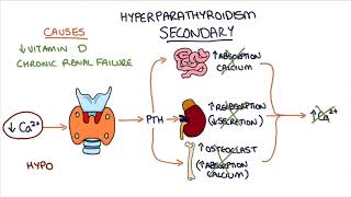 Understanding Hyperparathyroidism [upl. by Octavian]