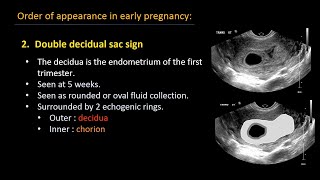 How to palpate beef cattle for pregnancy diagnosis [upl. by Lletnahc]