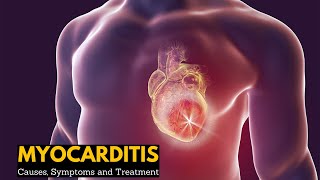 What is Cardiomyopathy Heart Muscle Disease [upl. by Cown442]