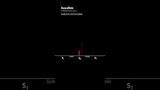 Abnormal Lung Sounds [upl. by Nilesoy]