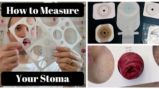 How to Measure Your Stoma OSTOMY TIPS [upl. by Jacinta]