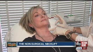 The nonsurgical necklift [upl. by Asilanna64]