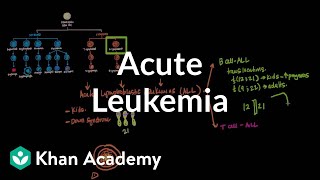 Chronic Lymphocytic Leukemia What Happens at Progression [upl. by Arvy]