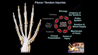 Flexor Tendon Injuries  Everything You Need To Know  Dr Nabil Ebraheim [upl. by Efal]