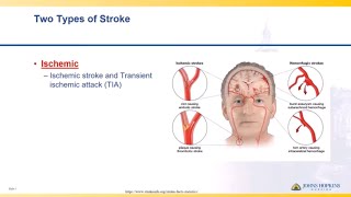 How Endovascular Stroke Treatment Works [upl. by Sinnaiy]