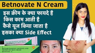 Betamethasone Valerate and Neomycin Skin Cream  Betnovate N Cream for Face  Uses [upl. by Saudra]