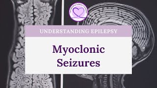 Status Epilepticus A Seizure Emergency [upl. by Case]