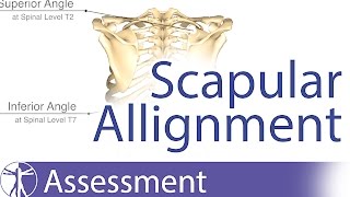 Scapular Alignment and possible causes for dyskinesia [upl. by Senalda738]