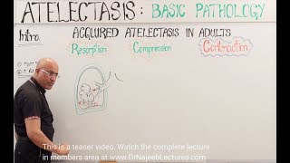 Atelectasis  Resorption Compression and Contraction [upl. by Dearborn]