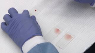 Making and staining blood smears [upl. by Yrekcaz]