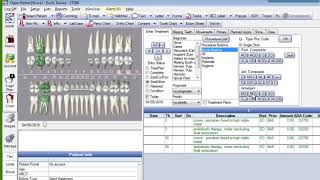 Entering Treatment Plans in Open Dental [upl. by Nevaj59]