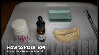 How to MixPlace IRM Intermediate Restorative Material [upl. by Valery]