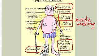 Endocrine Disorders [upl. by Drye]