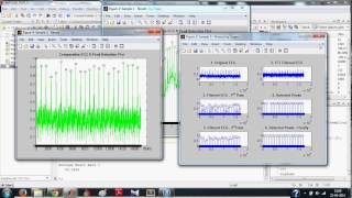 ECG Signal Processing in MATLAB  Detecting RPeaks Full [upl. by Orferd]