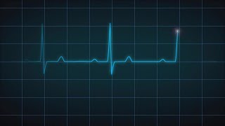 EKG Heart Monitor Flatline After Effects Templates [upl. by Mina]