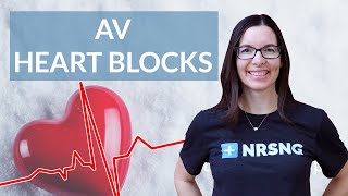 How to interpret AV Heart Blocks on an EKG strip [upl. by Ramo619]